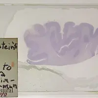 アインシュタインの脳切片  1955年以降 新潟大学脳研究所所蔵写真撮影：カールツァイスマイクロスコピー株式会社