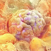 腎臓の糸球体©甲賀大輔・旭川医科大学/ 日立ハイテクノロジーズ/NHK ※画像はラットで撮影。白黒画像にイメージで色を付けています。