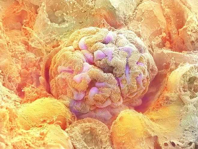 腎臓の糸球体©甲賀大輔・旭川医科大学/ 日立ハイテクノロジーズ/NHK ※画像はラットで撮影。白黒画像にイメージで色を付けています。